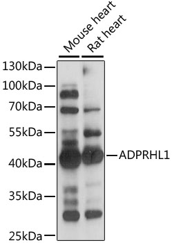 ADPRHL1 Polyclonal Antibody