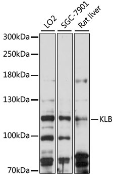 KLB Polyclonal Antibody
