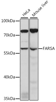 FARSA Polyclonal Antibody
