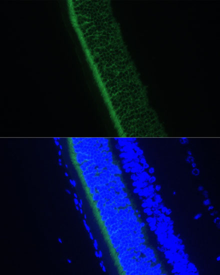 GNGT1 Polyclonal Antibody