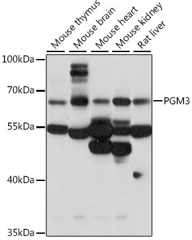 PGM3 Polyclonal Antibody