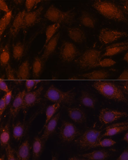 GCAT Polyclonal Antibody