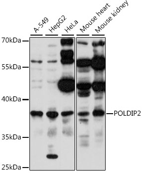 POLDIP2 Polyclonal Antibody