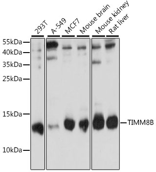 TIMM8B Polyclonal Antibody