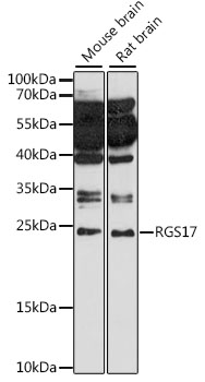 RGS17 Polyclonal Antibody