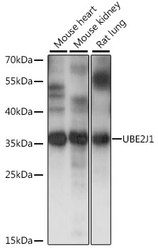 UBE2J1 Polyclonal Antibody