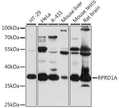RPRD1A Polyclonal Antibody