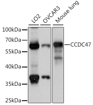 CCDC47 Polyclonal Antibody