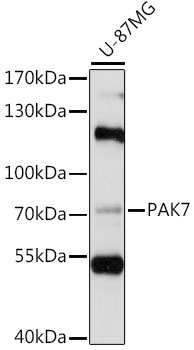 PAK5 Polyclonal Antibody