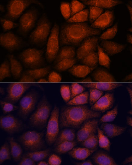 KIF13A Polyclonal Antibody