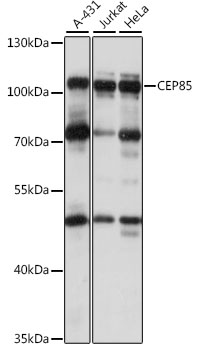 CEP85 Polyclonal Antibody