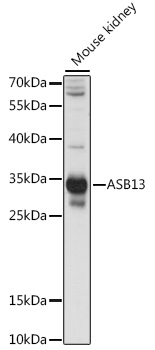 ASB13 Polyclonal Antibody