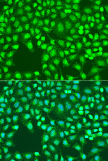 Defb26 Polyclonal Antibody