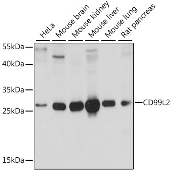 CD99L2 Polyclonal Antibody