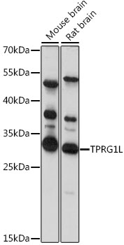 TPRG1L Polyclonal Antibody