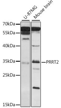 PRRT2 Polyclonal Antibody