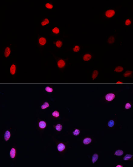 ERCC5 antibody
