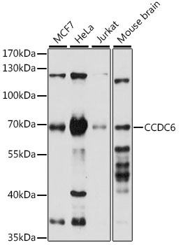 CCDC6 Polyclonal Antibody