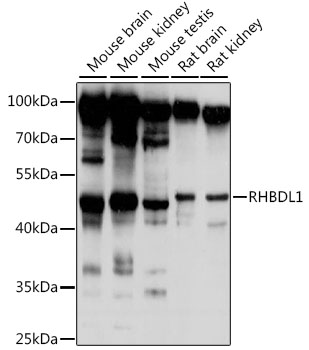 RHBDL1 Polyclonal Antibody