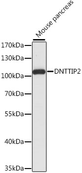 DNTTIP2 Polyclonal Antibody