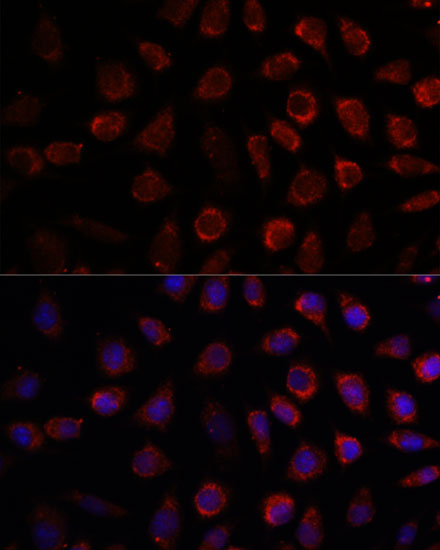 PDE11A Polyclonal Antibody