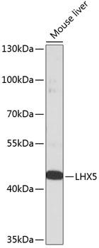 LHX5 Polyclonal Antibody