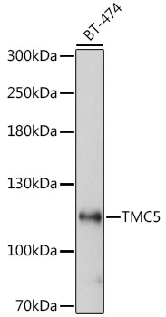 TMC5 Polyclonal Antibody