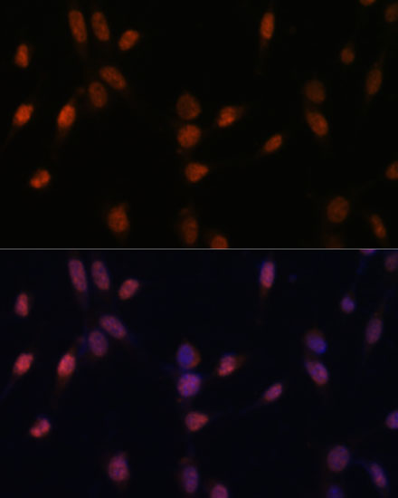 USP33 Polyclonal Antibody