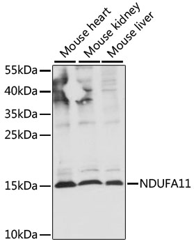 NDUFA11 Polyclonal Antibody