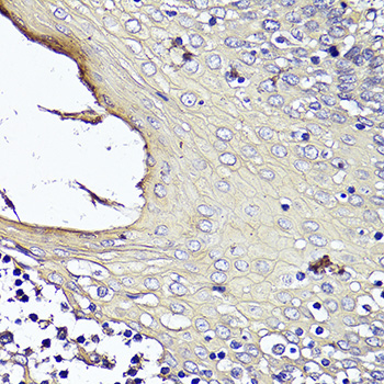 KRT1 Polyclonal Antibody