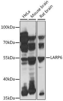 LARP6 Polyclonal Antibody