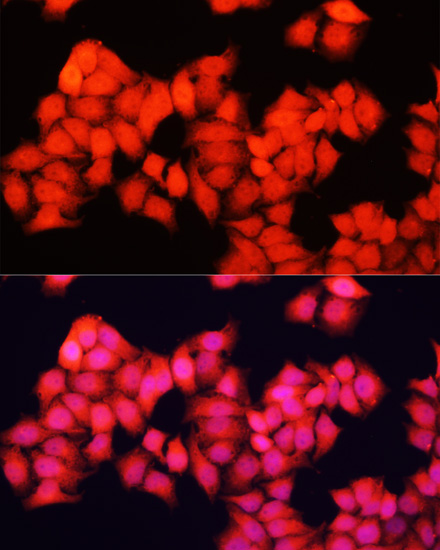 ARAF Polyclonal Antibody