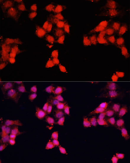 ENO3 Polyclonal Antibody