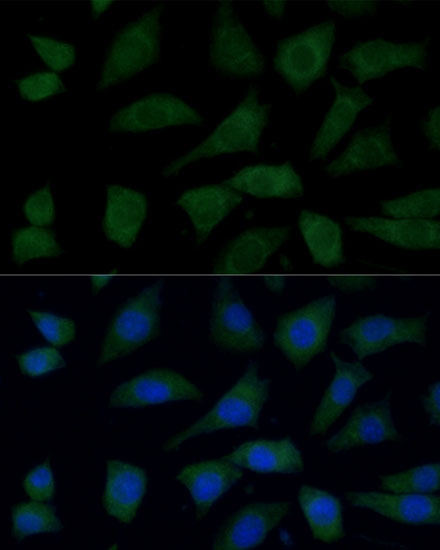 FGD1 Polyclonal Antibody