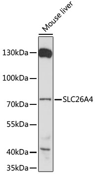 SLC26A4 Polyclonal Antibody