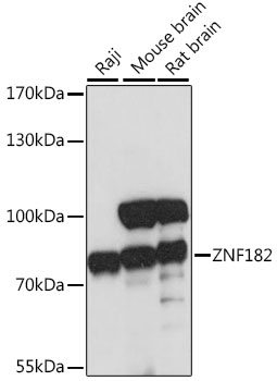 ZNF182 Polyclonal Antibody