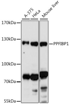 PPFIBP1 Polyclonal Antibody