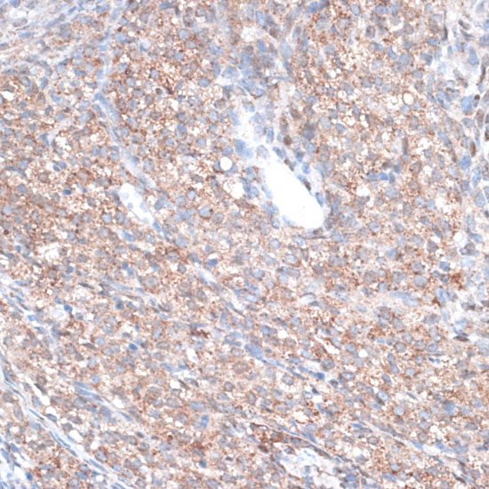 PLAA Polyclonal Antibody