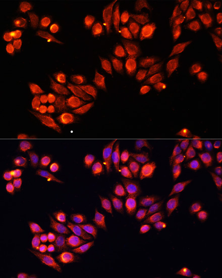 Heparanase 1 Polyclonal Antibody