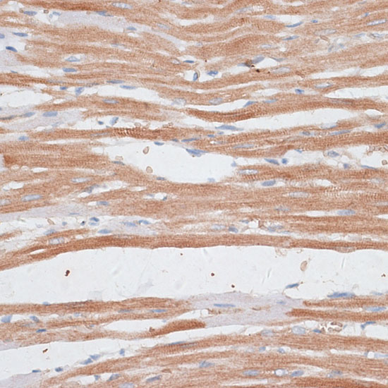 KATNA1 Polyclonal Antibody