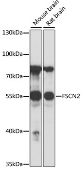 FSCN2 Polyclonal Antibody