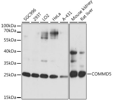 COMMD5 Polyclonal Antibody