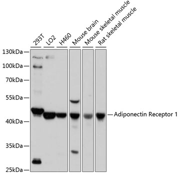 Adiponectin Receptor 1 Polyclonal Antibody