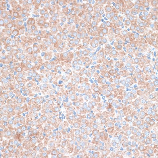 PMEPA1 Polyclonal Antibody