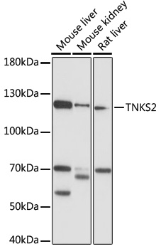 TNKS2 Polyclonal Antibody