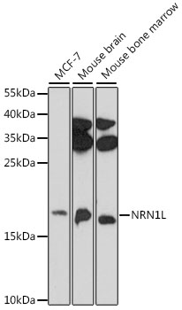 NRN1L Polyclonal Antibody