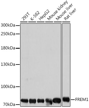 FREM1 Polyclonal Antibody