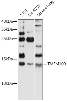 TMEM100 Polyclonal Antibody