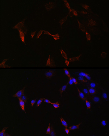 PLA2G5 Polyclonal Antibody