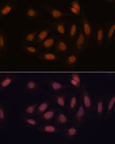SNIP1 Polyclonal Antibody